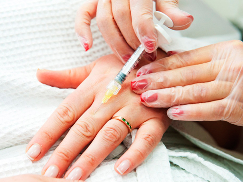 Инъекционные методы омоложения кожи рук